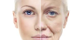 Top Skin and Wellness Benefits of Anti Aging Treatment in Dwarka