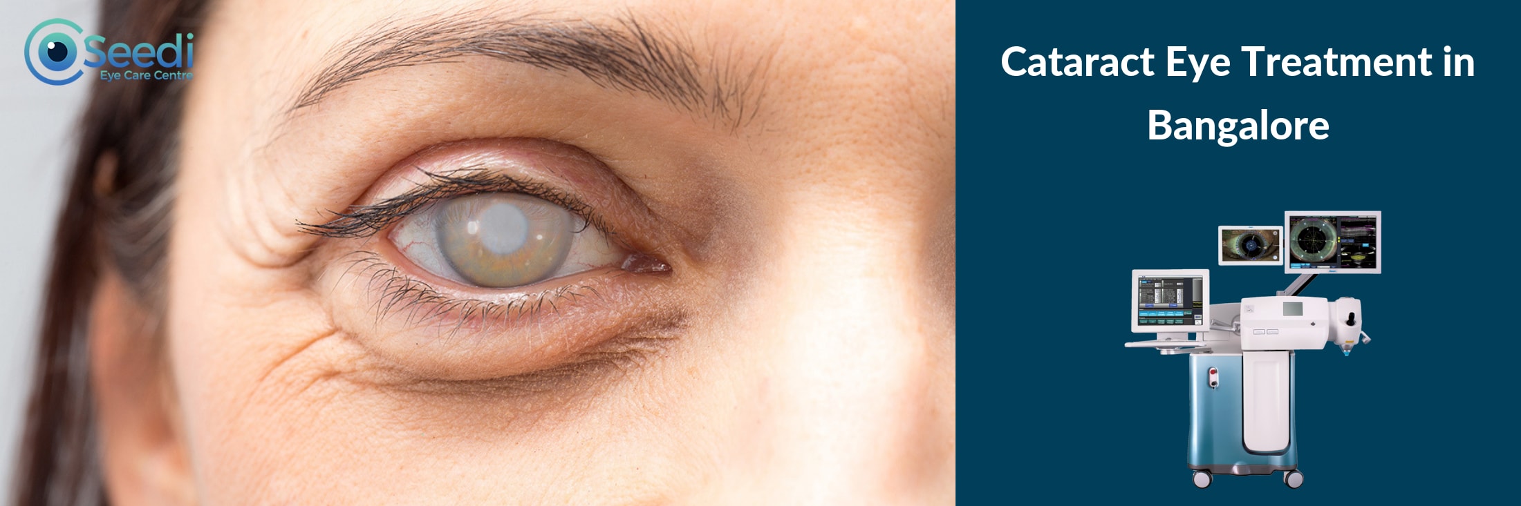Best Cataract Surgeon In Bangalore | Cost Of Cataract Eye Surgery In Bangalore