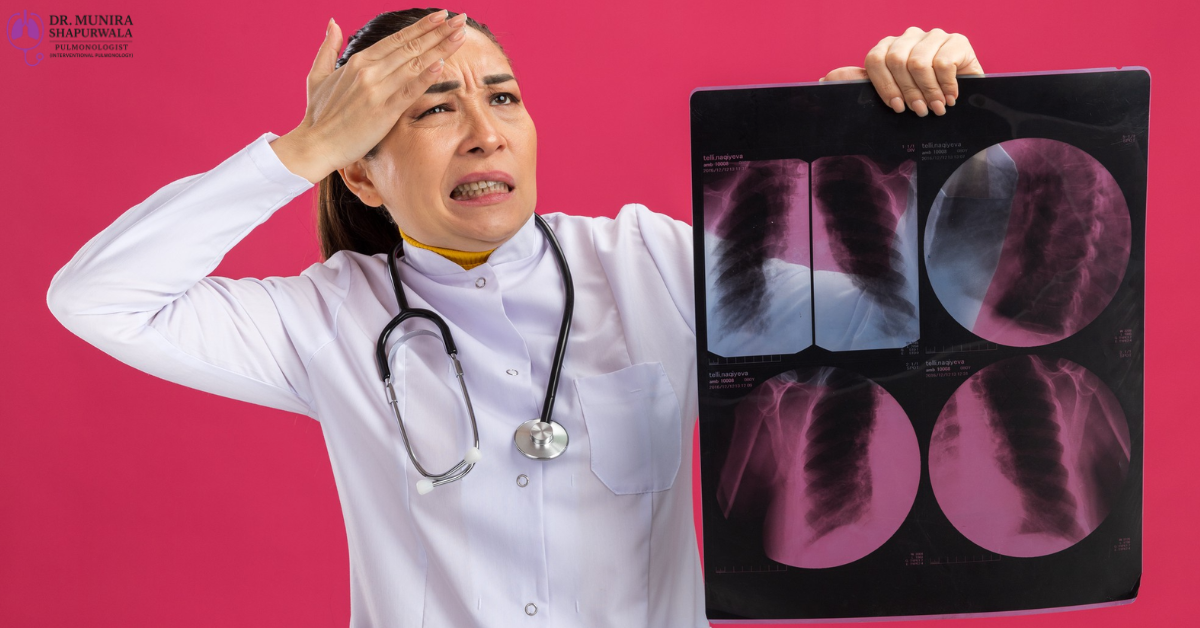 Understanding Pulmonary Embolism: A Comprehensive Guide