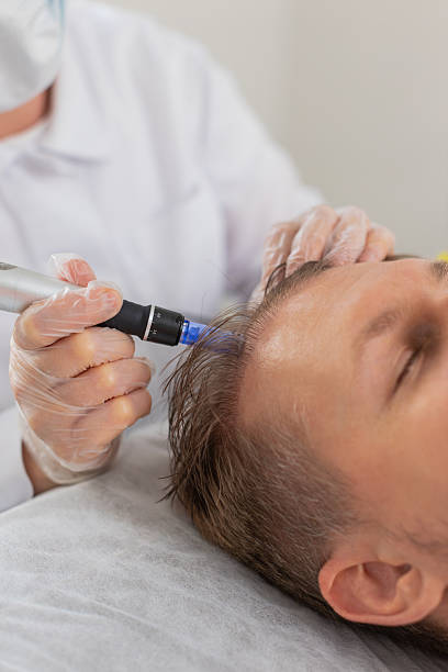 Exosomes Therapy for Hair Loss in Riyadh – Affordable & Reliable Options