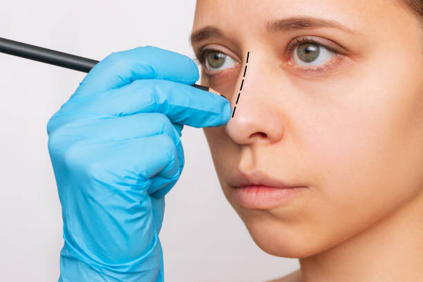 مراجعة تجربتي لعملية تجميل الأنف بالرياض وأفضل النصائح المفيدة