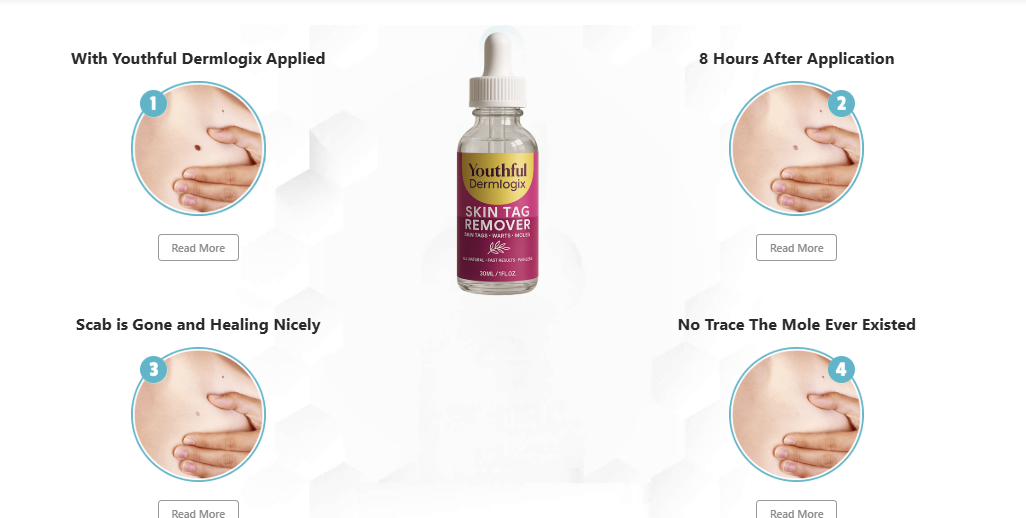 Youthful Dermlogix Skin Tag Remover