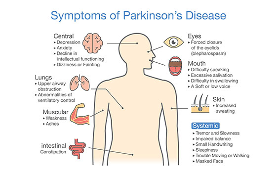Understanding Parkinson’s Disease: Symptoms, Diagnosis, and Expert Solutions