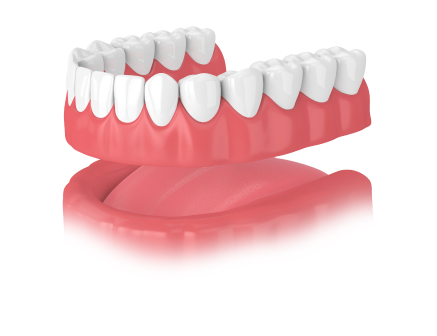 Permanent Dentures with Implants: The Future of Long-Lasting Smiles