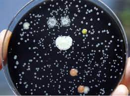 Top 7 Signs You Need Immediate Legionella Testing