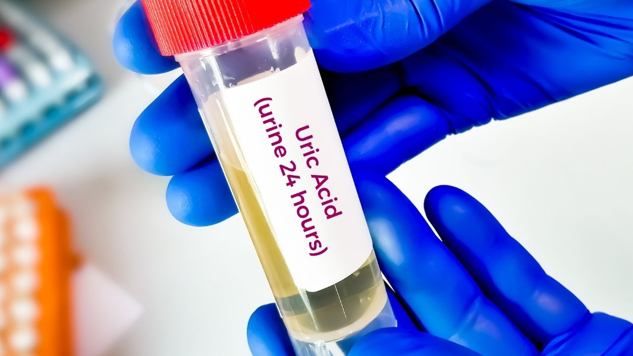 Uric Acid in the Body