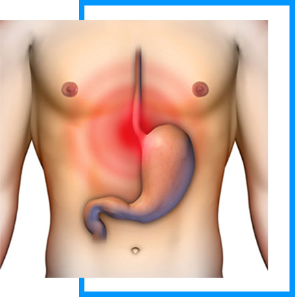 Laparoscopic Gallbladder Removal Surgery in New Delhi India