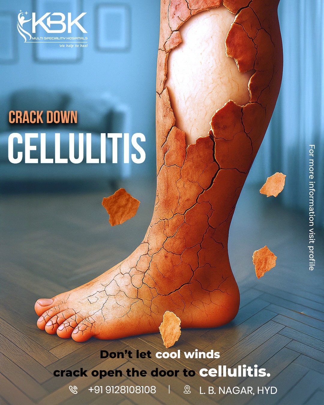Cellulitis: Symptoms, Causes, and Effective Cellulitis Treatment