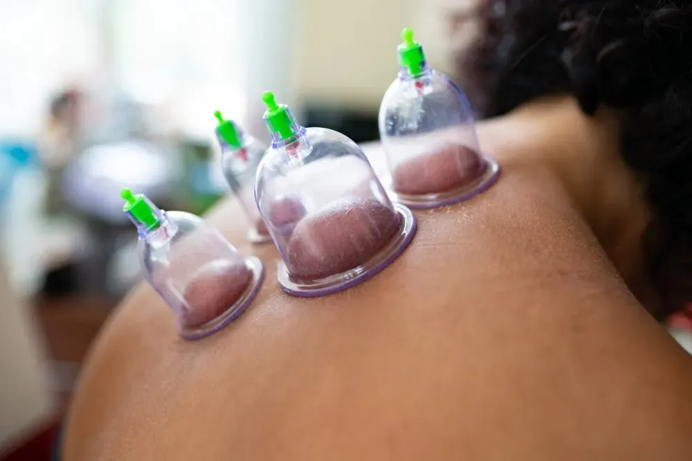 Hijama Treatment for Immune System Boost
