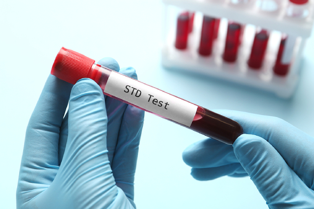 STD Test Awareness for Young Adults