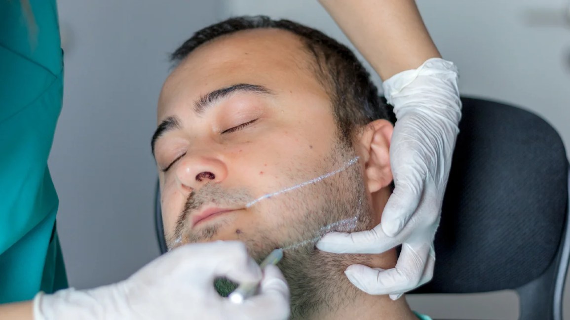 Juvederm Fillers for Chin Contouring: What You Should Know