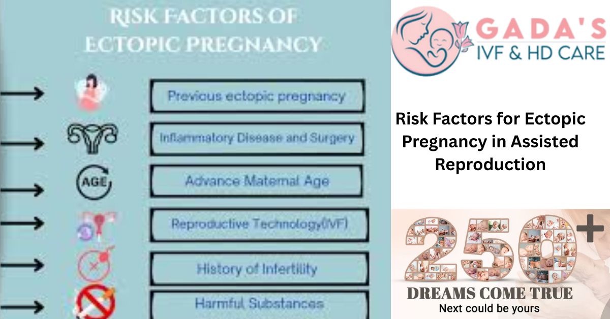 Risk Factors for Ectopic Pregnancy in Assisted Reproduction