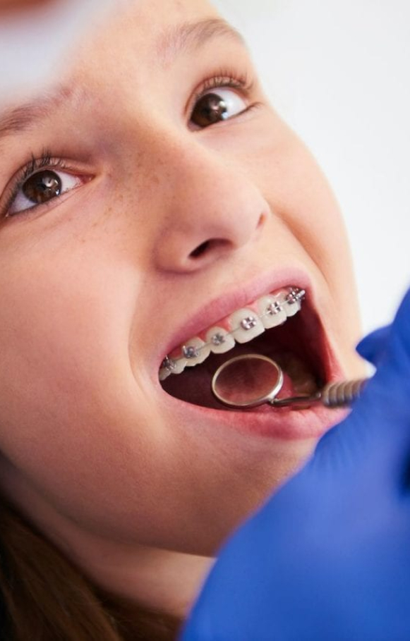 Orthodontist Bankstown Offering Braces and Aligners