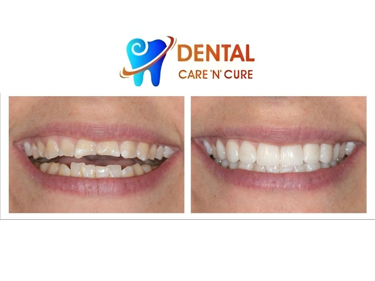 Finding the Best Dental Clinics in Paschim Vihar