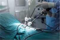 Minimally Invasive Surgery Market 2020 World Analysis and Forecast to 2025