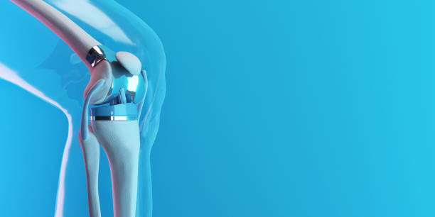 Sensor-Enabled Knee Implants for Better Recovery at Terna Hospital