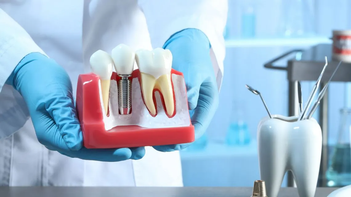 Looking for the Best Dental Implant Clinic in Dubai? Here’s What International Patients & Dubai Residents Should Know