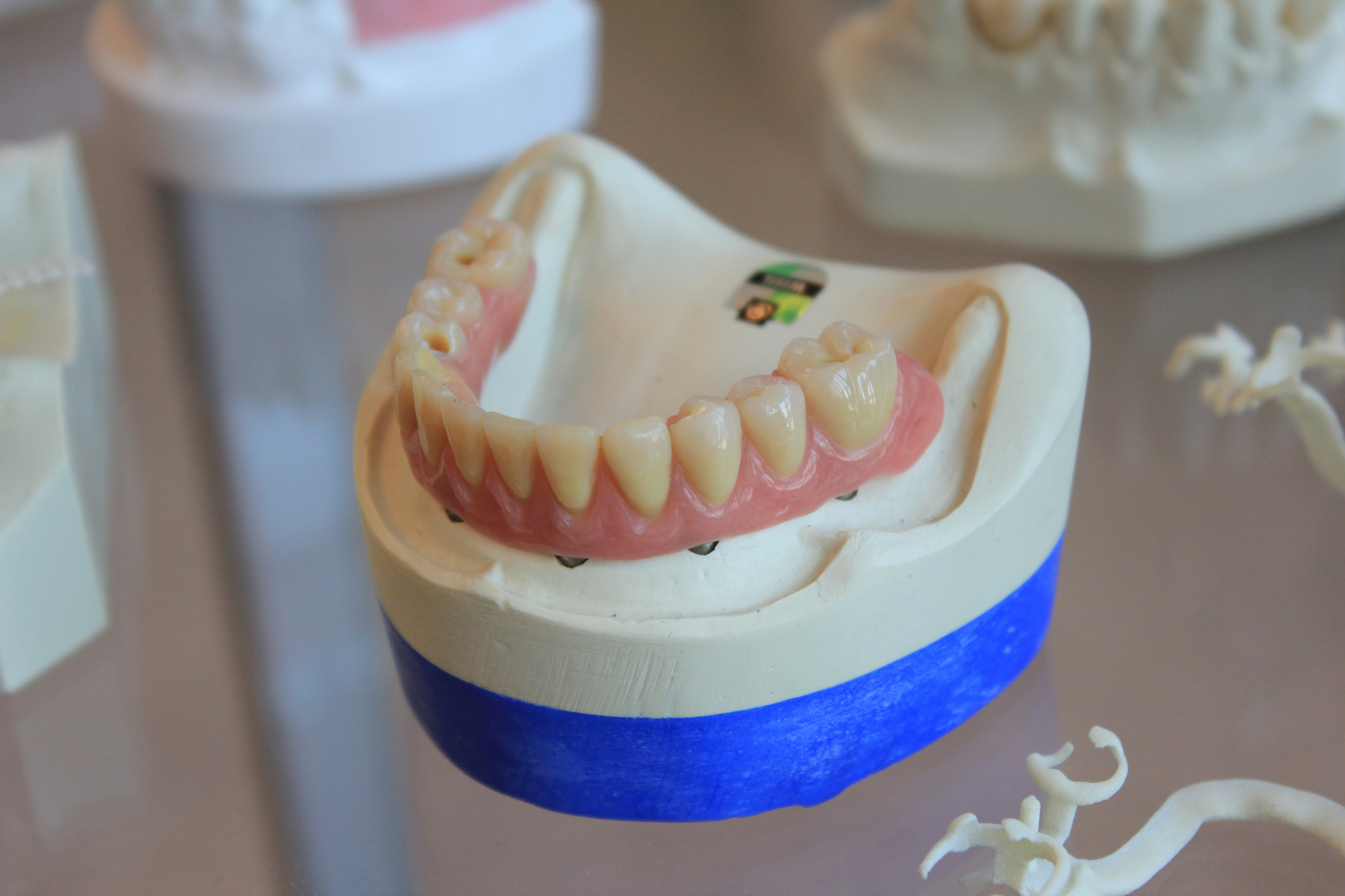 Top Dental Implants in Mumbai: Restore Your Smile with Precision and Care