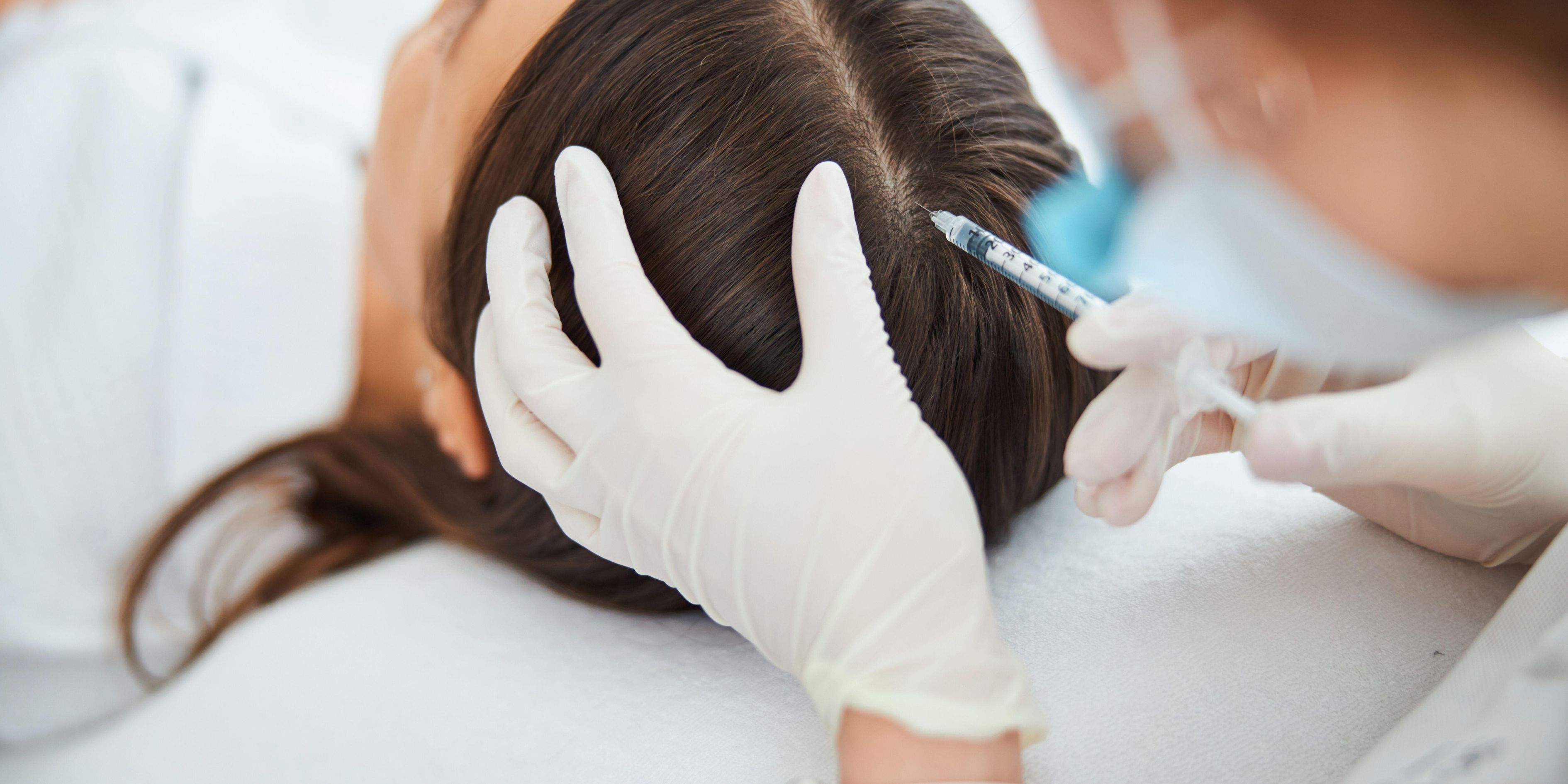Finasteride for Hair Loss: Dosage, Results Timeline, and Side Effects