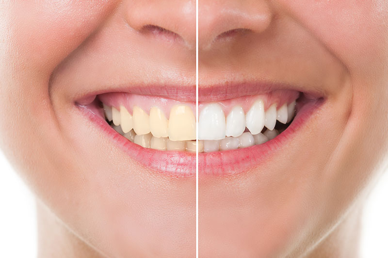 How to Choose the Right Dentist for Your Family?