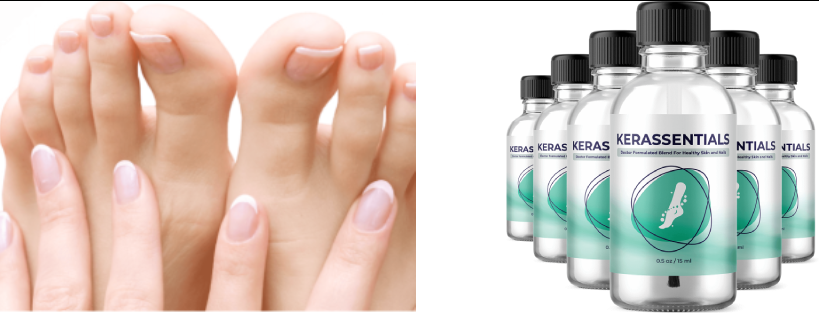 Kerassentials [I've Tested] TRUTH EXPOSED!