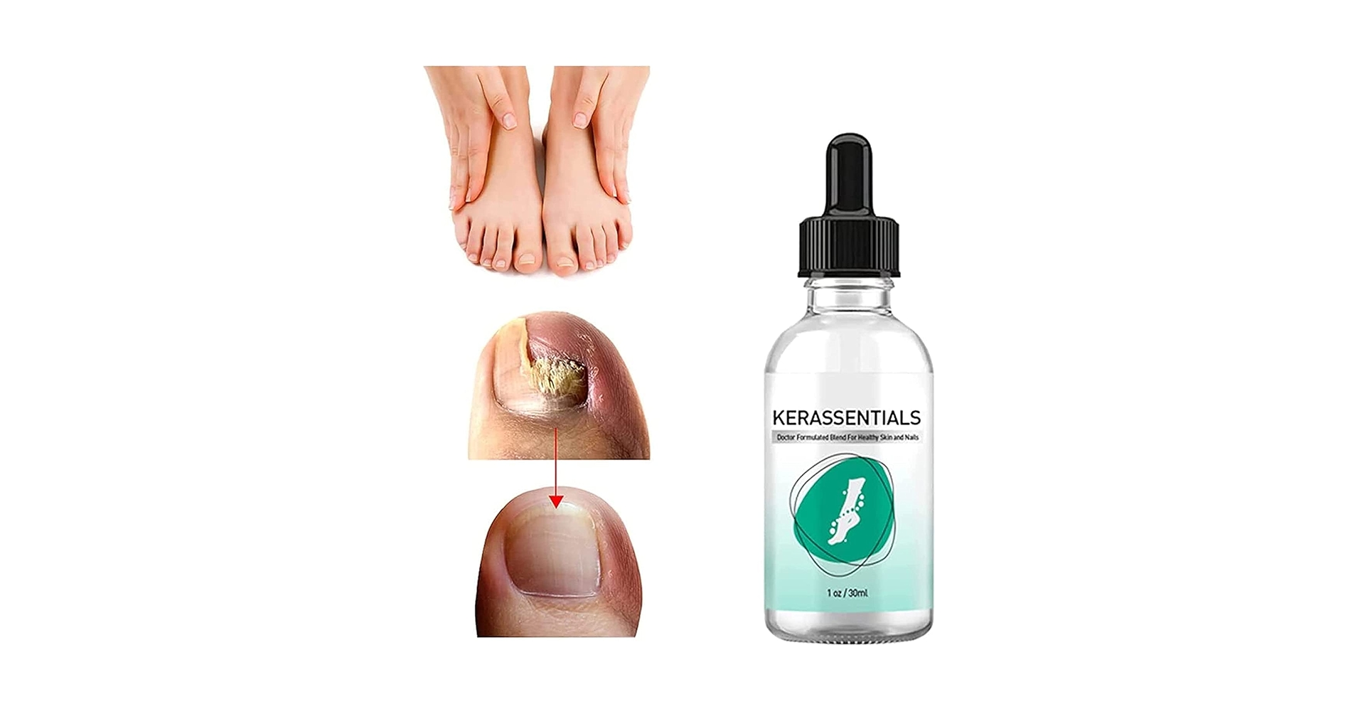 Kerassentials Review 2026: Top Effective or Buy?