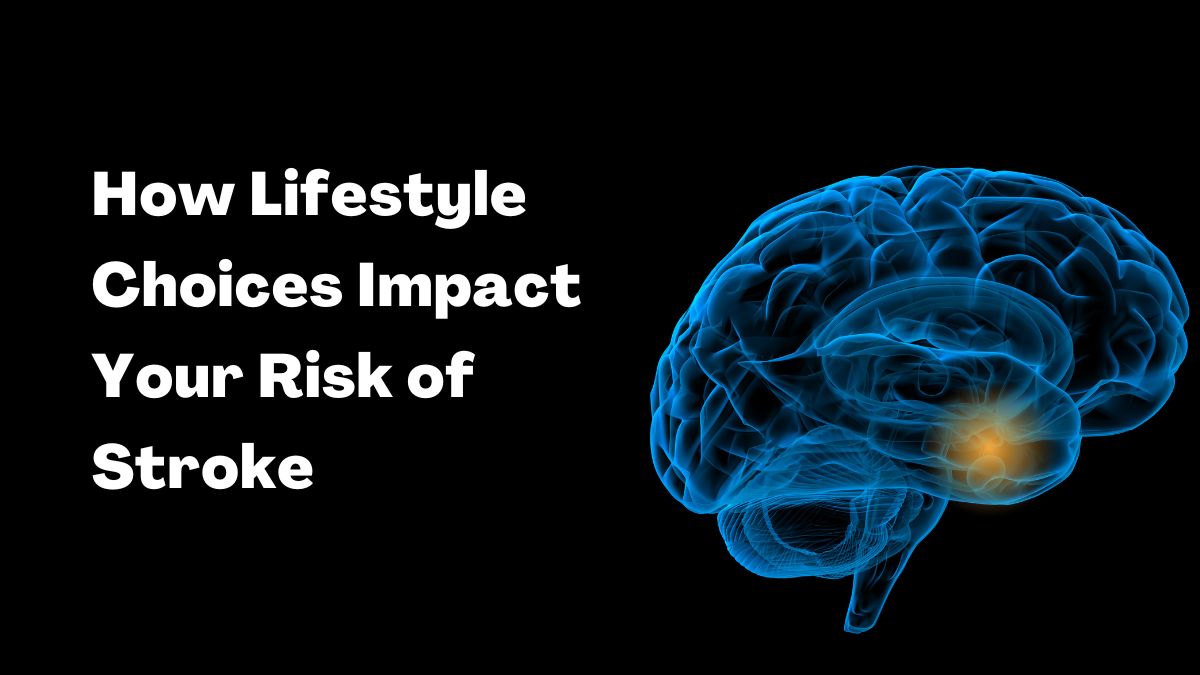 How Lifestyle Choices Impact Your Risk of Stroke