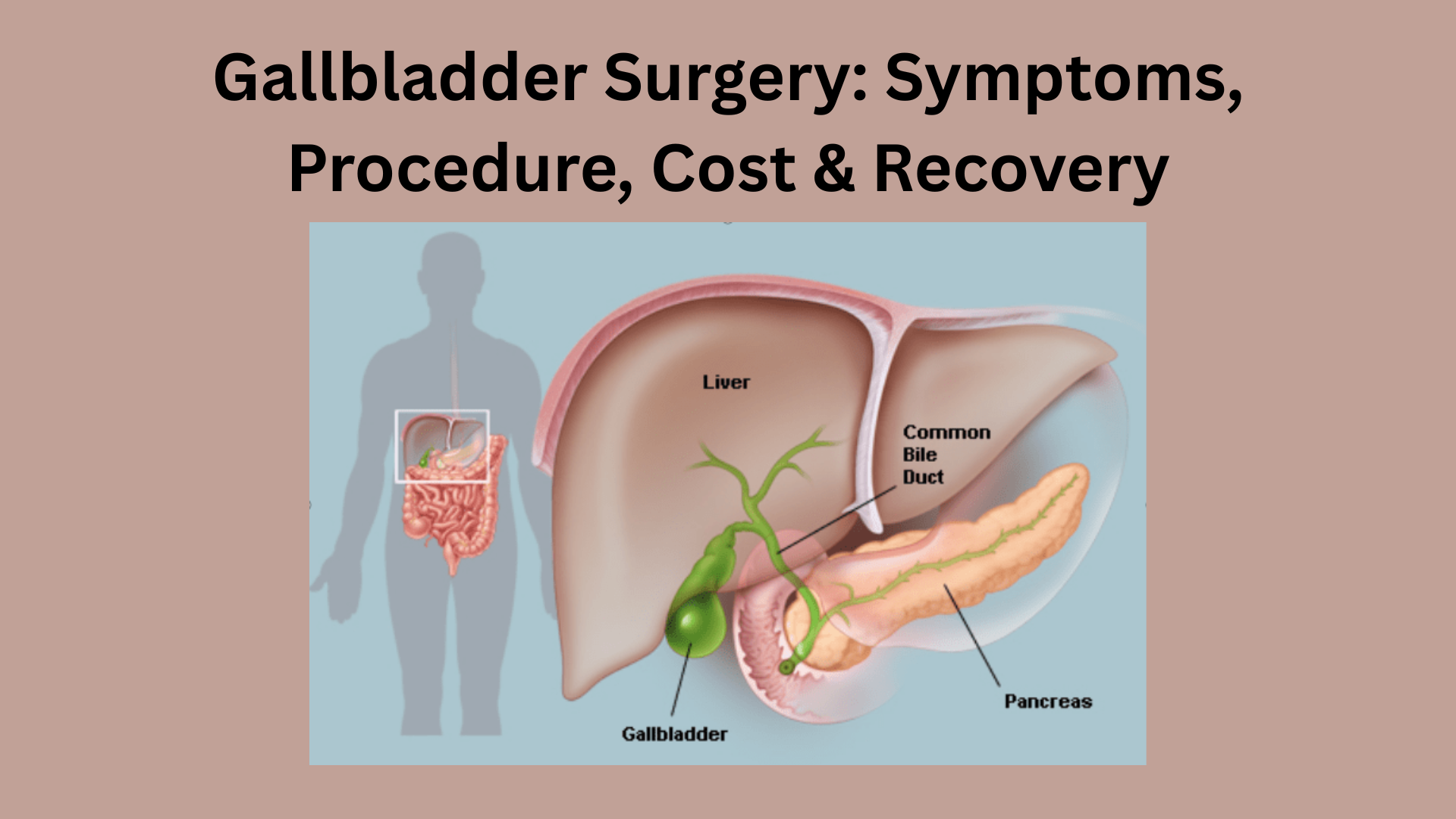 Gallbladder Surgery: Symptoms, Procedure, Cost & Recovery