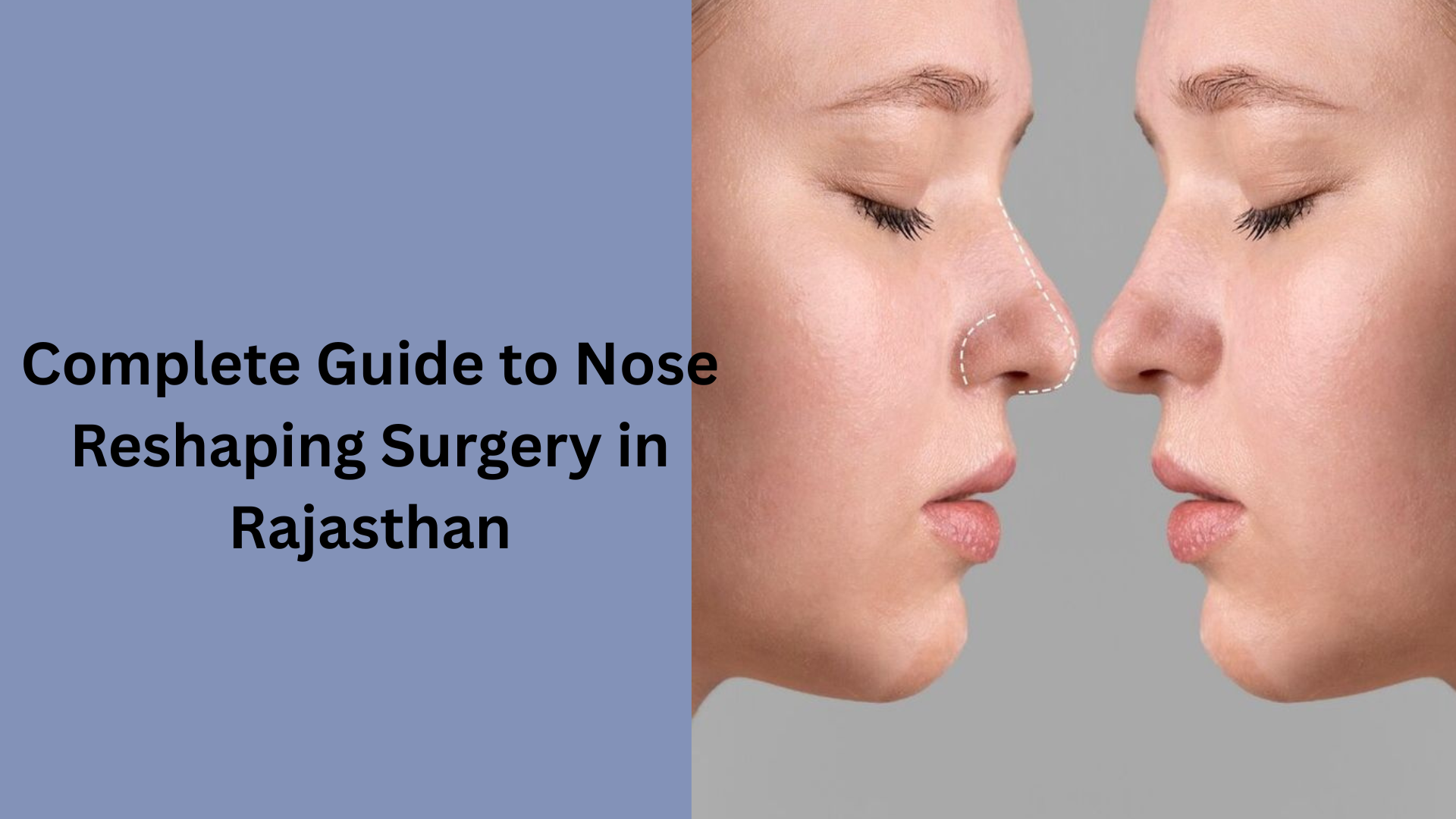 Complete Guide to Nose Reshaping Surgery in Rajasthan