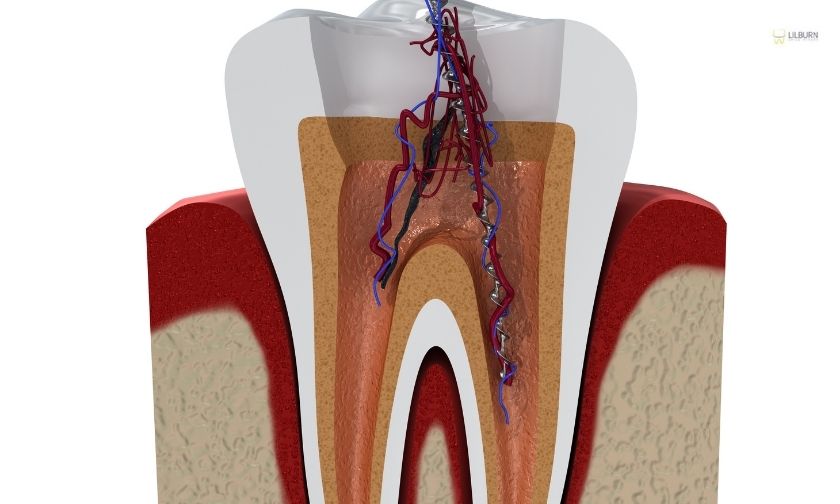 Root Canal Treatment Process: Step-by-Step Guide for Patients