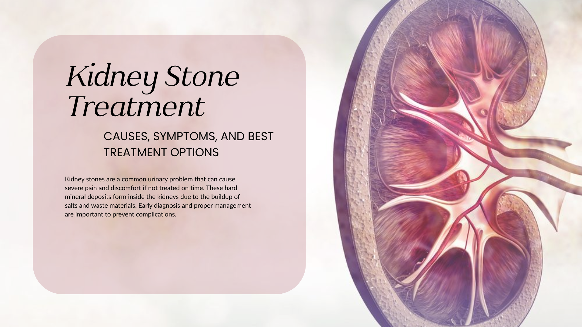 Kidney Stone Treatment: Causes, Symptoms, and Best Treatment Options