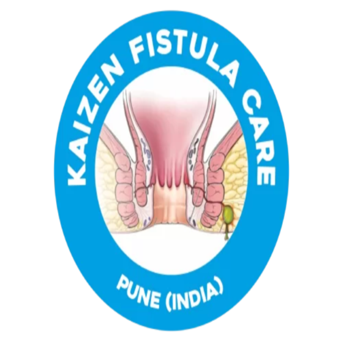 Struggling with Chronic Piles? Meet the Best Piles Doctor in Pune
