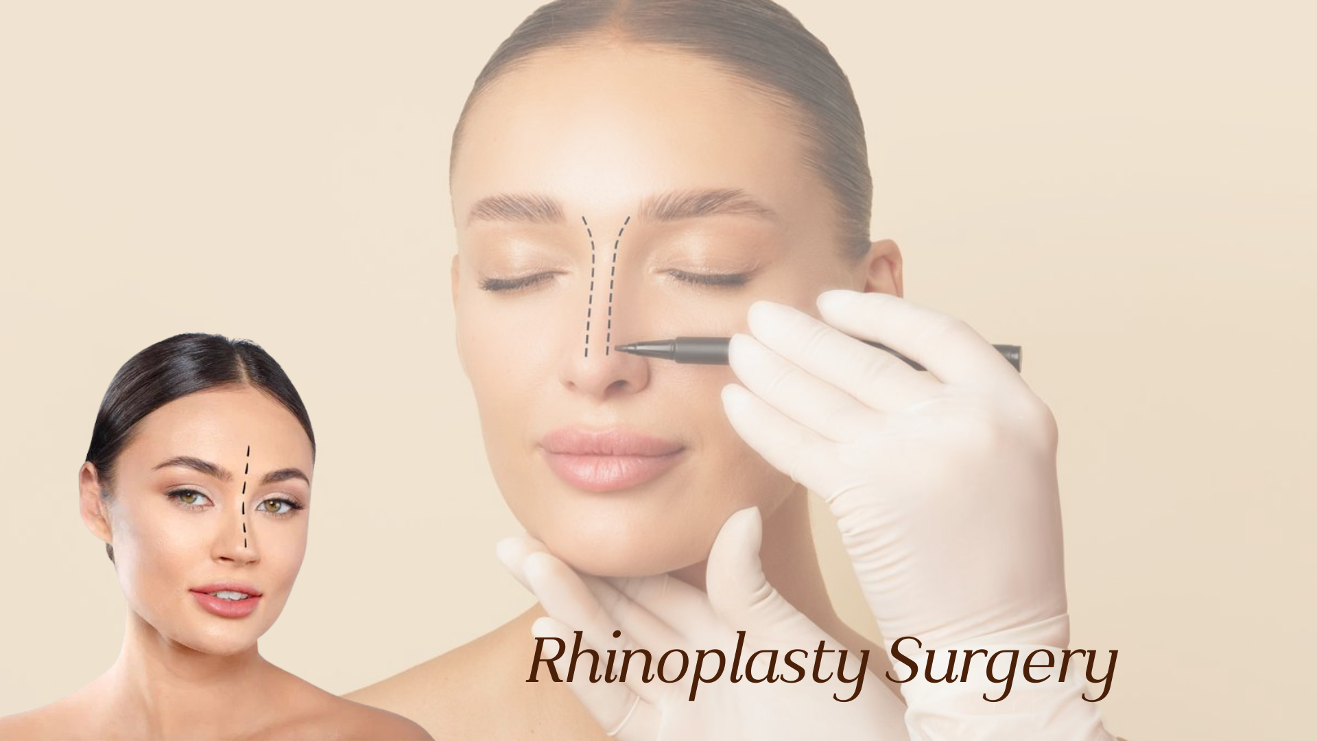 Complete Guide to Rhinoplasty Surgery: Benefits, Procedure & Recovery