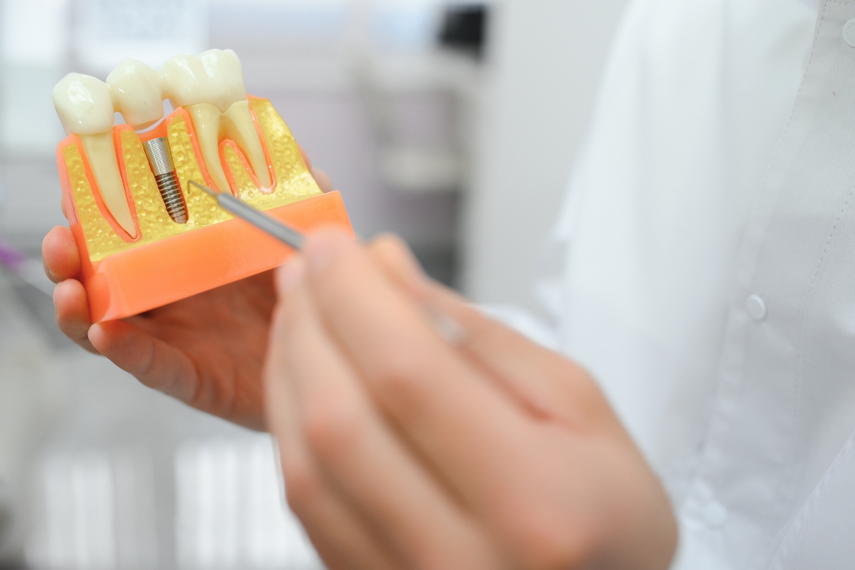 Are Dental Implants Painful? Honest Answer from a Fort Worth Dentist