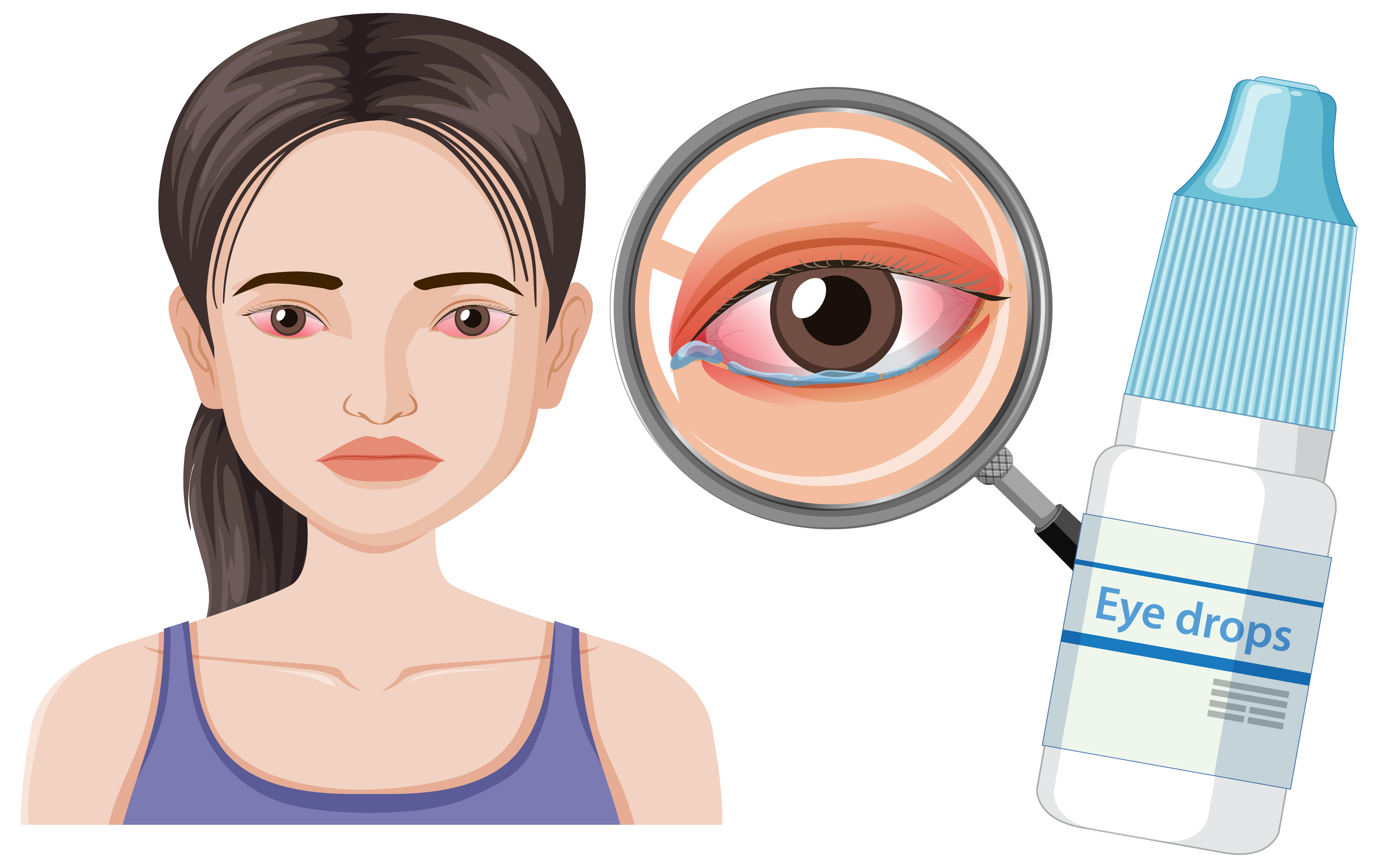 Eye Flu Lakshan: Causes, Treatment & Prevention Tips
