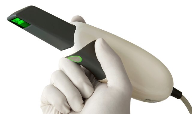 Global Digital Impression Standalone Scanners Market Report 2020 Forecast to 2025