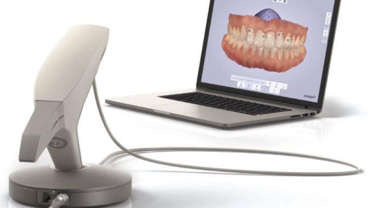 Global Intra Oral Scanners for Digital Impression Market Report 2020 Forecast to 2025