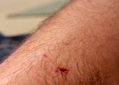 Dog Bite Attorney Ventura