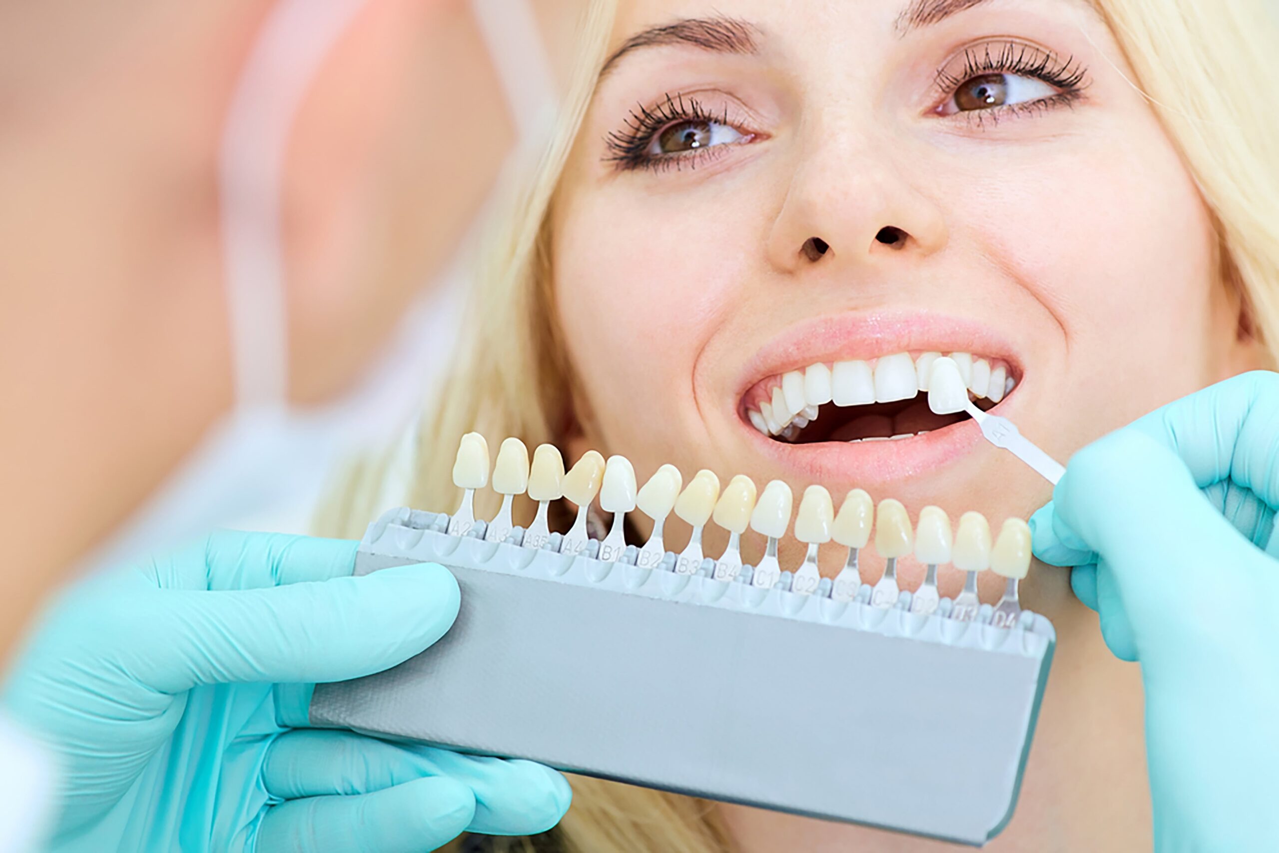 Can Dental Cleanings Replace Whitening Treatments?