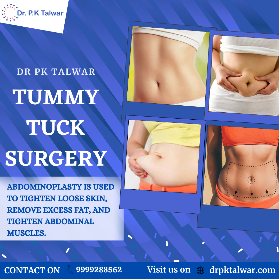 Tummy Tuck Surgery in Delhi