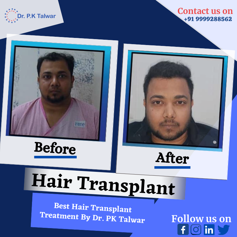 Cosmetic suregery in Dr PK Talwar Clinic