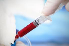 Global Blood Irradiator Market Analysis | Industry Report 2027