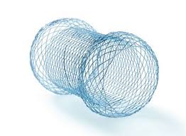 World Enteral Stents Market by Product Type, Market Players and Regions-Forecast to 2025 Report