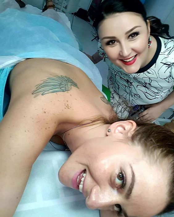 Permanent Laser Tattoo Removal Dubai