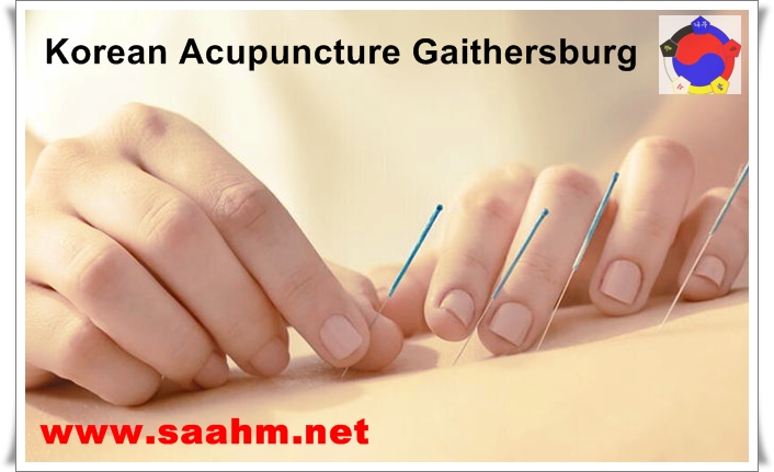 Best Korean Acupuncture Gaithersburg - KOSA