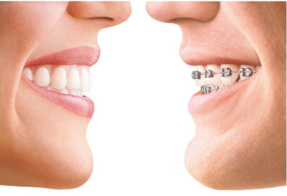 Best Dentist In Delhi