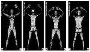 Full Body Scanner Market Leading Players Analysis Report 2020