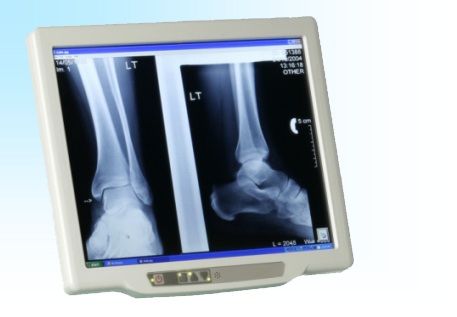 Global Medical Tablet PC Market Manufacturers Analysis Report 2020-2025