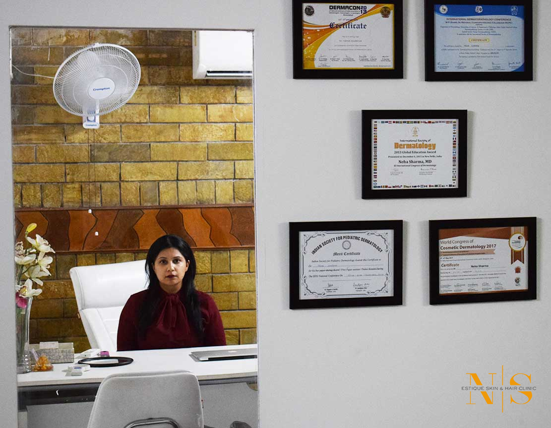 Chemical Peel for Acne in Gurgaon