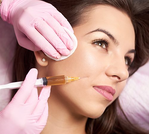 Best lip fillers london